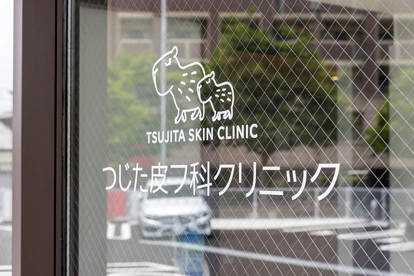 入口
